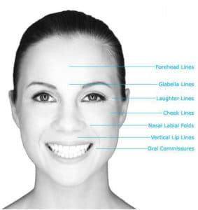 Evolutions Santa Barbara Dermal Fillers Treatment Areas Evolutions Santa Barbara Dermal Fillers Treatment Areas